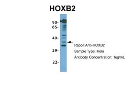 HOXB2 Rabbit anti-Human, Polyclonal, Novus Biologicals 0.1 mL | Buy Online | Novus Biologicals | Fisher Scientific